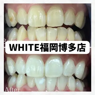 メンズ セルフホワイトニング WHITE福岡博多店のエステ・リラクイメージ