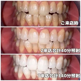 LIGHT Beauty 関内店所属・ライトビューティー 関内店のその他イメージ