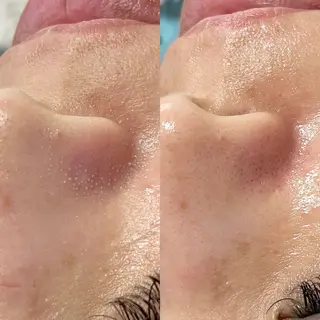 メンズ キッズ salonLADYSTYLE所属・稲嶺 美華のエステ・リラクイメージ