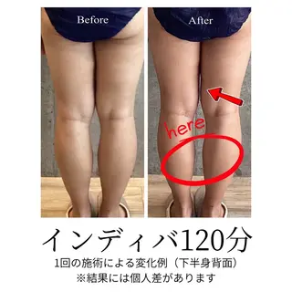 さくらんぼ鍼灸院所属・美容鍼&温活・免活 さくらんぼ鍼灸院のエステ・リラクイメージ