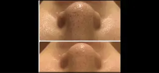 リラクゼーション ルナのエステ・リラクイメージ