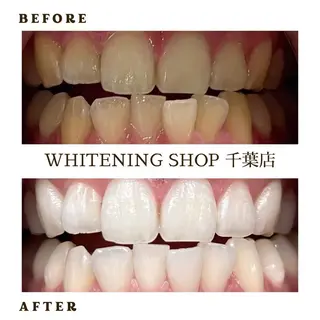 メンズ ホワイトニング ショップ千葉店のその他イメージ