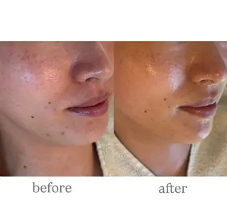 anthes /MIHOのエステ・リラクイメージ