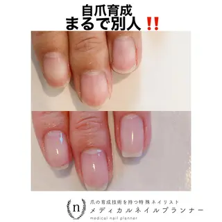 ネイル NAIL SALON ｔｏｇｇｙのネイルデザイン