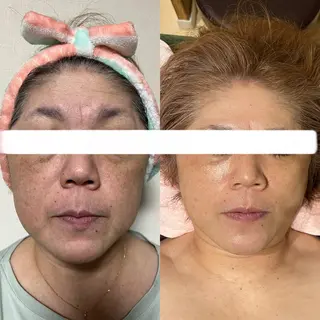 Relaxation SalonARONAのエステ・リラクイメージ