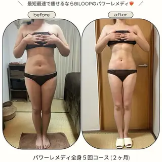 biloop所属・《本気痩せ×疲労改善 》  BILOOPのエステ・リラクイメージ
