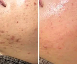 近藤 みさきのエステ・リラクイメージ