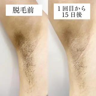 ダイエットラボ梅田店 🌟のエステ・リラクイメージ