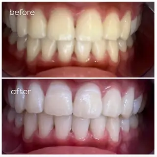 エクシア津駅前店所属・セルフホワイトニング エクシア津駅前店のその他イメージ