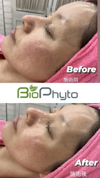 プルソワン心斎橋所属・プルソワン心斎橋松田 千絵子のエステ・リラクイメージ