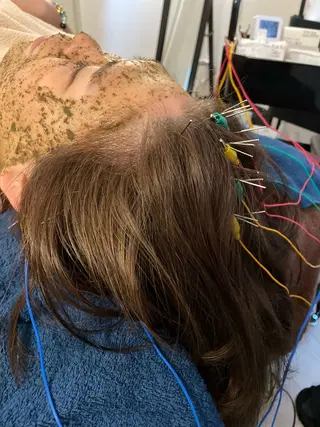 美楽鍼 びらくしんのその他イメージ