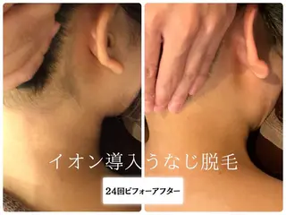 Beauty salon Lino所属・🎀うなじ脱毛🎀 ㅣLino堀江のエステ・リラクイメージ