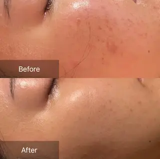 for woman所属・森 美優のエステ・リラクイメージ