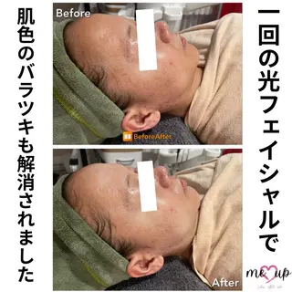 Meupニキビ専門店 背中/ハーブ/肌管理のその他イメージ