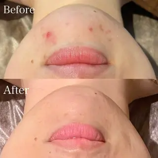 小顔×痩身専門サロンCLORE浦和店所属・石川 彩花のエステ・リラクイメージ