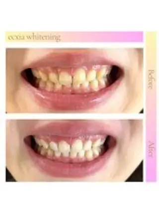 セルフホワイトニング エクシア西宮北口店所属・セルフホワイトニング エクシア西宮北口店のその他イメージ