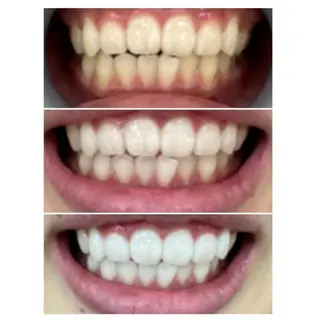 M渋谷店所属・Ｍ渋谷 ホワイトニングのエステ・リラクイメージ