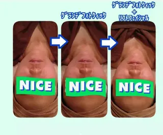 ラブニール 恵比寿店のエステ・リラクイメージ