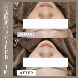 サロンVega所属・店長 金光のエステ・リラクイメージ