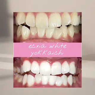 ホワイトニングサロン エクシア四日市店のその他イメージ