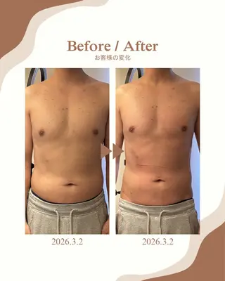 les SALON所属・美肌脱毛／慢性疲労 ／肩こり／むくみのエステ・リラクイメージ