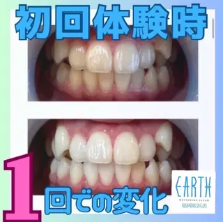 メンズ ホワイトニングサロン EARTH福岡姪浜店のその他イメージ