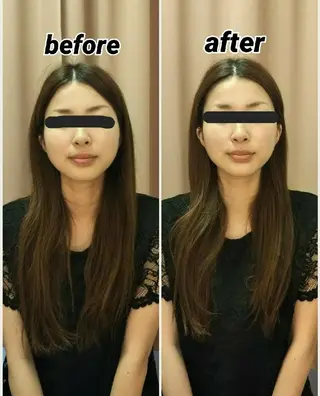 小顔と美肌 まごころエステMatoria所属・小顔 美肌専門 Matoriaのエステ・リラクイメージ