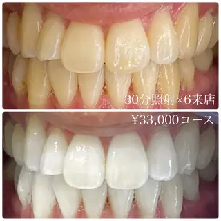 メンズ キッズ ホワイトニングルーム　川崎店所属・ホワイトニング ルーム　川崎店のその他イメージ