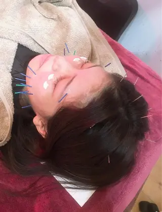 美容鍼灸女性専用 りんご鍼灸治療院のエステ・リラクイメージ