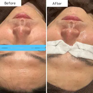 Beauty  salon Lien所属・大村市Lien＊ 中川内翔子のエステ・リラクイメージ