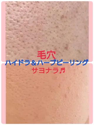 ハーブピーリング 専門店Kikkaのエステ・リラクイメージ