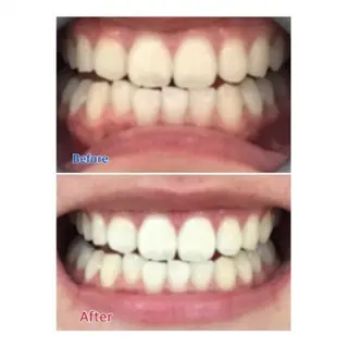 M渋谷店所属・Ｍ渋谷 ホワイトニングのエステ・リラクイメージ