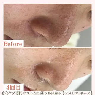 毛穴ケア専門サロン Amélio Beauté所属・毛穴ケア専門サロン アメリオボーテのその他イメージ