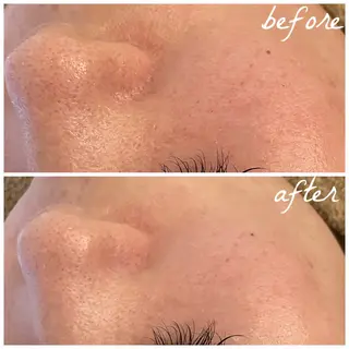 メンズ メナード岐阜市茜部 杉浦のエステ・リラクイメージ