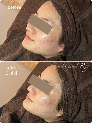 R eyのネイルデザイン