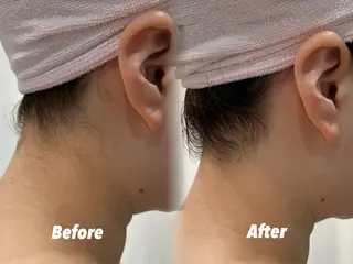 🫧美しい素肌へ🫧 今成柚乃のその他イメージ