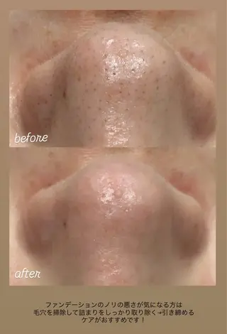 DahliaBeauty ダリアビューティー所属・DahliaBeau tyフェイシャル中村のエステ・リラクイメージ