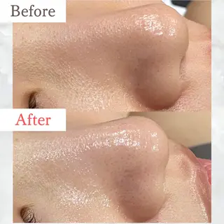 サロンボーテアネラ燕三条所属・サロンボーテアネラ 燕三条のエステ・リラクイメージ