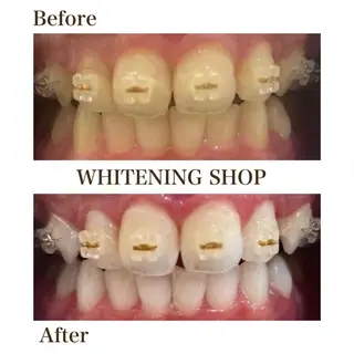 ホワイトニング ショップ川越店のエステ・リラクイメージ