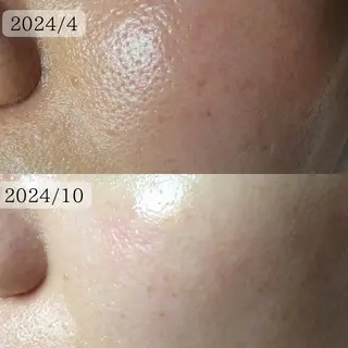 エステサロン Lazulisea所属・川口 春奈のエステ・リラクイメージ