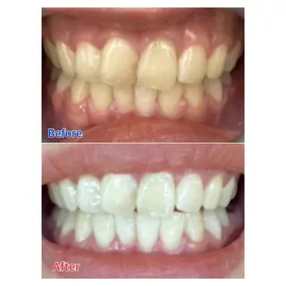 MBEAUTYSALON 千葉店・京成大久保所属・Melty 輝のその他イメージ