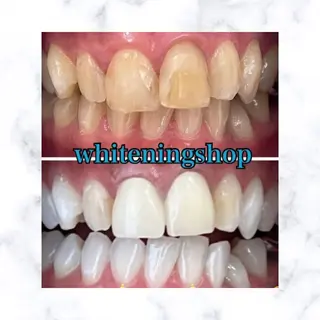 ホワイトニングショップ時津店所属・ホワイトニング ショップ長崎時津店のその他イメージ