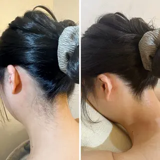 うなじ脱毛/美肌脱毛 LABELのエステ・リラクイメージ