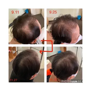 ヘアアレンジ 全身もみほぐし もみの樹のエステ・リラクイメージ