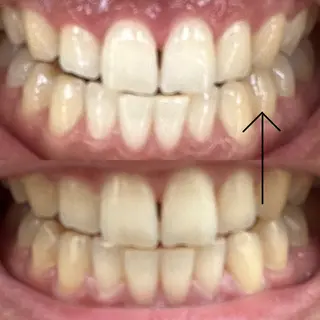 エクシアホワイトニング草津店所属・nanami -ホワイトニングのその他イメージ