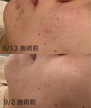 mili mili beauty salon所属・mili mili 岡本のエステ・リラクイメージ