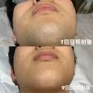 メンズ hanaCoco+plus所属・hanacoco ＋plusのマツエク・マツパデザイン