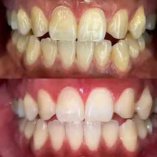 セルフホワイトニングビューティー三川店所属・中村 江梨香のその他イメージ