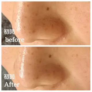 フェイシャル専門サロ ン ERINのエステ・リラクイメージ