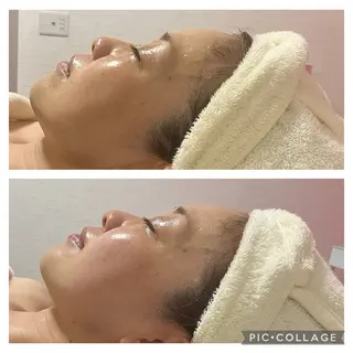 メディカルエステ 痩身·小顔専門サロンBBC 田園調布所属・KEI KOのエステ・リラクイメージ